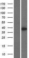 MBNL3 Human Over-expression Lysates NM_018388