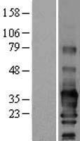 SCN3B Human Over-expression Lysates NM_001040151