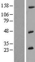 IL26 Human Over-expression Lysates NM_018402