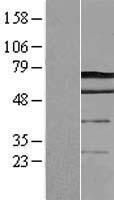 DCP1A Human Over-expression Lysates NM_018403