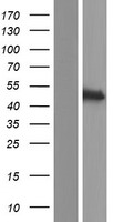 Centaurin alpha 2 (ADAP2) Human Over-expression Lysates NM_018404