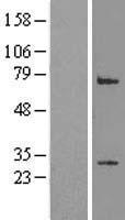 LRP2BP Human Over-expression Lysates NM_018409