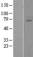 ST6GALNAC1 Human Over-expression Lysates NM_018414