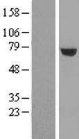 ls055813 utp6 human over expression lysates nm 018428 wb testing 1