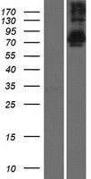 TSNAXIP1 Human Over-expression Lysates NM_018430
