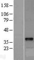 DOK5 Human Over-expression Lysates NM_018431