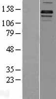ls055818 kdm3a jhdm2a kdm3a human over expression lysates nm 018433 wb testing 1