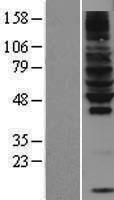 RNF130 Human Over-expression Lysates NM_018434