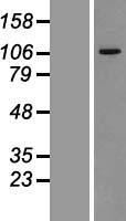 VPS11 Human Over-expression Lysates NM_021729