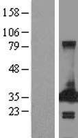 PECR Human Over-expression Lysates NM_018441