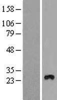 ls055831 tmem111 emc3 human over expression lysates nm 018447 wb testing 1