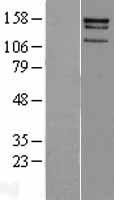 CENPJ Human Over-expression Lysates NM_018451