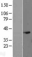 EAPP Human Over-expression Lysates NM_018453