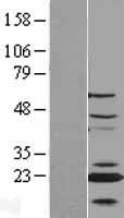 ls055839 cenpn human over expression lysates nm 018455 wb testing 2