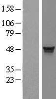MDS028 (ITFG2) Human Over-expression Lysates NM_018463
