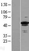 ZC3H15 Human Over-expression Lysates NM_018471