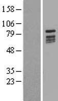 C20orf19 (KIZ) Human Over-expression Lysates NM_018474