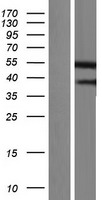 Gasdermin like (GSDMB) Human Over-expression Lysates NM_001165958