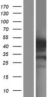 Gasdermin like (GSDMB) Human Over-expression Lysates NM_001165959