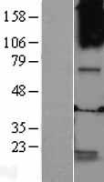 GABRQ Human Over-expression Lysates NM_018558
