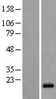 LIM domain only 3 (LMO3) Human Over-expression Lysates NM_018640