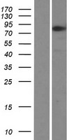 ZNF167 (ZKSCAN7) Human Over-expression Lysates NM_018651