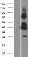 GPRC5C Human Over-expression Lysates NM_018653