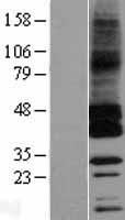 GPRC5C Human Over-expression Lysates NM_022036