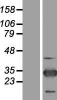 ZNF313 (RNF114) Human Over-expression Lysates NM_018683