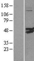 CMAS Human Over-expression Lysates NM_018686