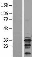 BIN3 Human Over-expression Lysates NM_018688