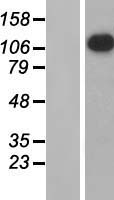 APOB48R (APOBR) Human Over-expression Lysates NM_018690
