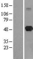 LANCL2 Human Over-expression Lysates NM_018697