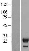 NXT2 Human Over-expression Lysates NM_018698