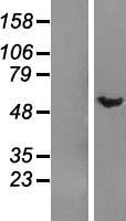 DMAP1 Human Over-expression Lysates NM_001034023