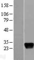 Apolipoprotein M (APOM) Human Over-expression Lysates NM_019101