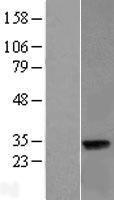 LIN37 Human Over-expression Lysates NM_019104