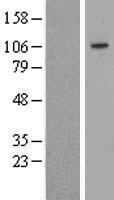 Sulfatase 2 (SULF2) Human Over-expression Lysates NM_018837