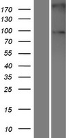 Sulfatase 2 (SULF2) Human Over-expression Lysates NM_198596