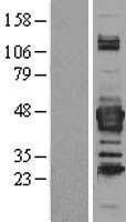 Septin 3 (SEPT3) Human Over-expression Lysates NM_145733