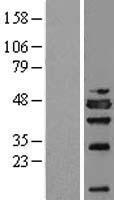 NSFL1C Human Over-expression Lysates NM_016143