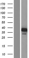 NSFL1C Human Over-expression Lysates NM_018839
