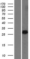 BAP29 (BCAP29) Human Over-expression Lysates NM_018844