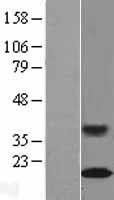 RAG1AP1 (SLC50A1) Human Over-expression Lysates NM_018845
