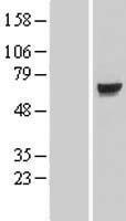 KLHL7 Human Over-expression Lysates NM_001031710