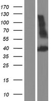 PDGFC Human Over-expression Lysates NM_016205