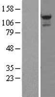 STK31 Human Over-expression Lysates NM_031414