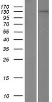 TDRD1 Human Over-expression Lysates NM_198795