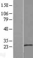 MOSPD1 Human Over-expression Lysates NM_019556