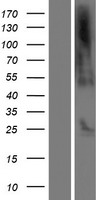 C21orf62 Human Over-expression Lysates NM_001162496